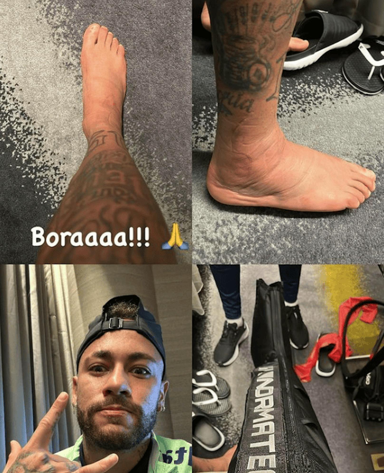 Neymar postet seinen verletzten Fuß auf Instagram