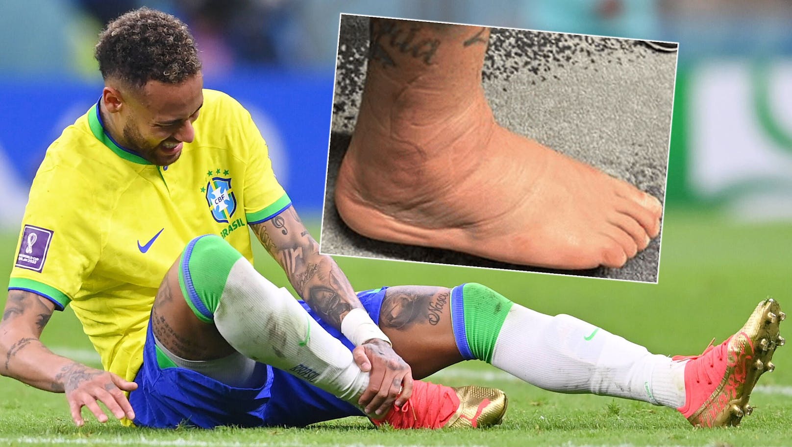 Neymar zeigt seinen verletzten Fuß