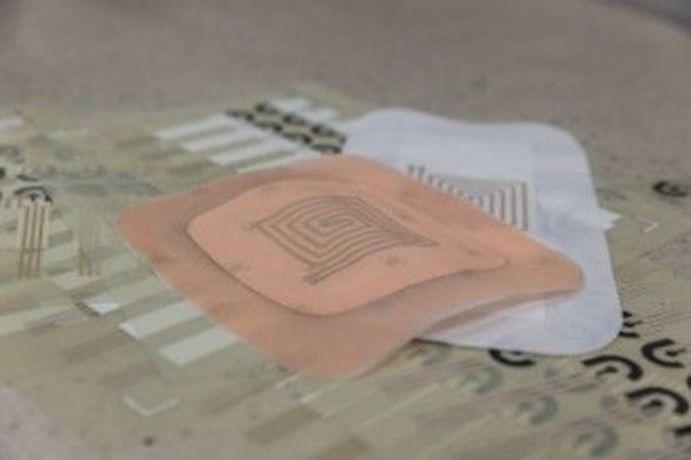 Durch den SmartHeal soll die Wundheilung optimiert werden.