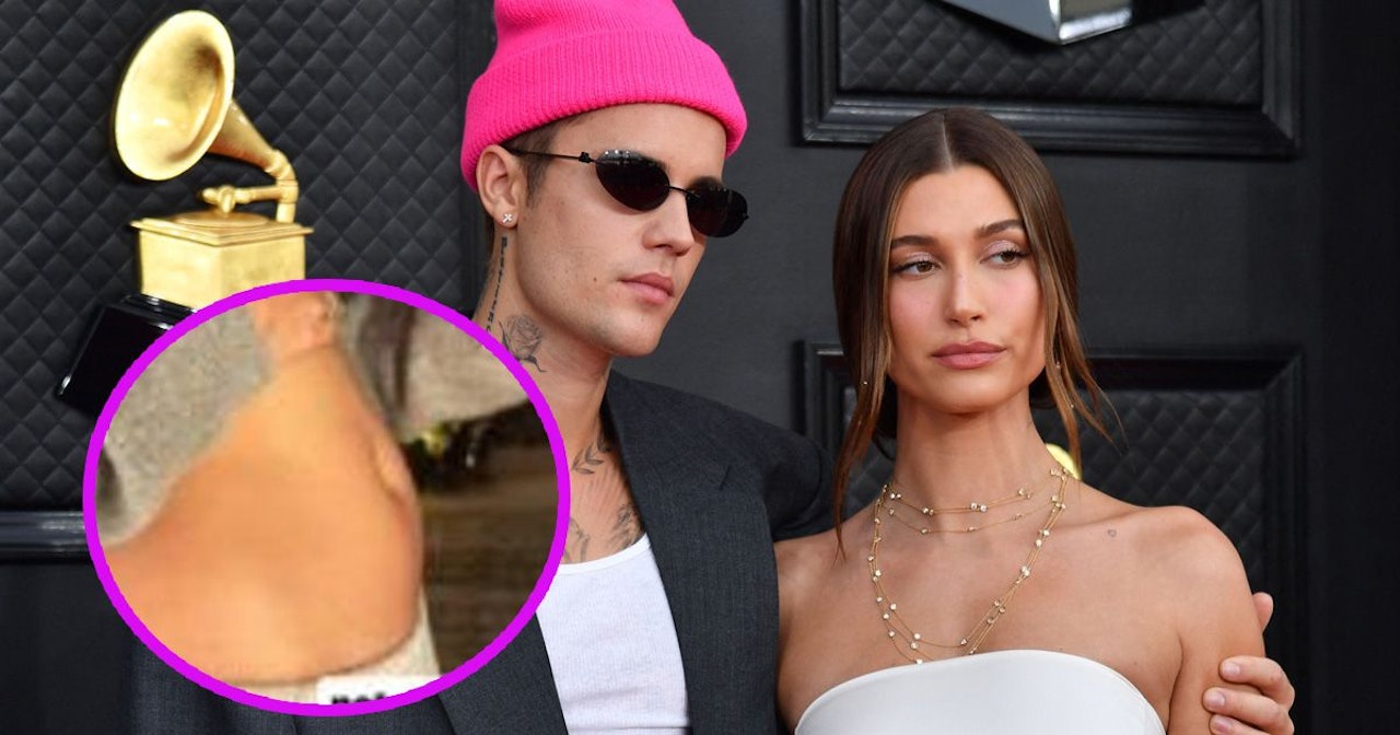 Heute.at - Groß wie Apfel – Hailey Bieber verrät Grund für Bauch