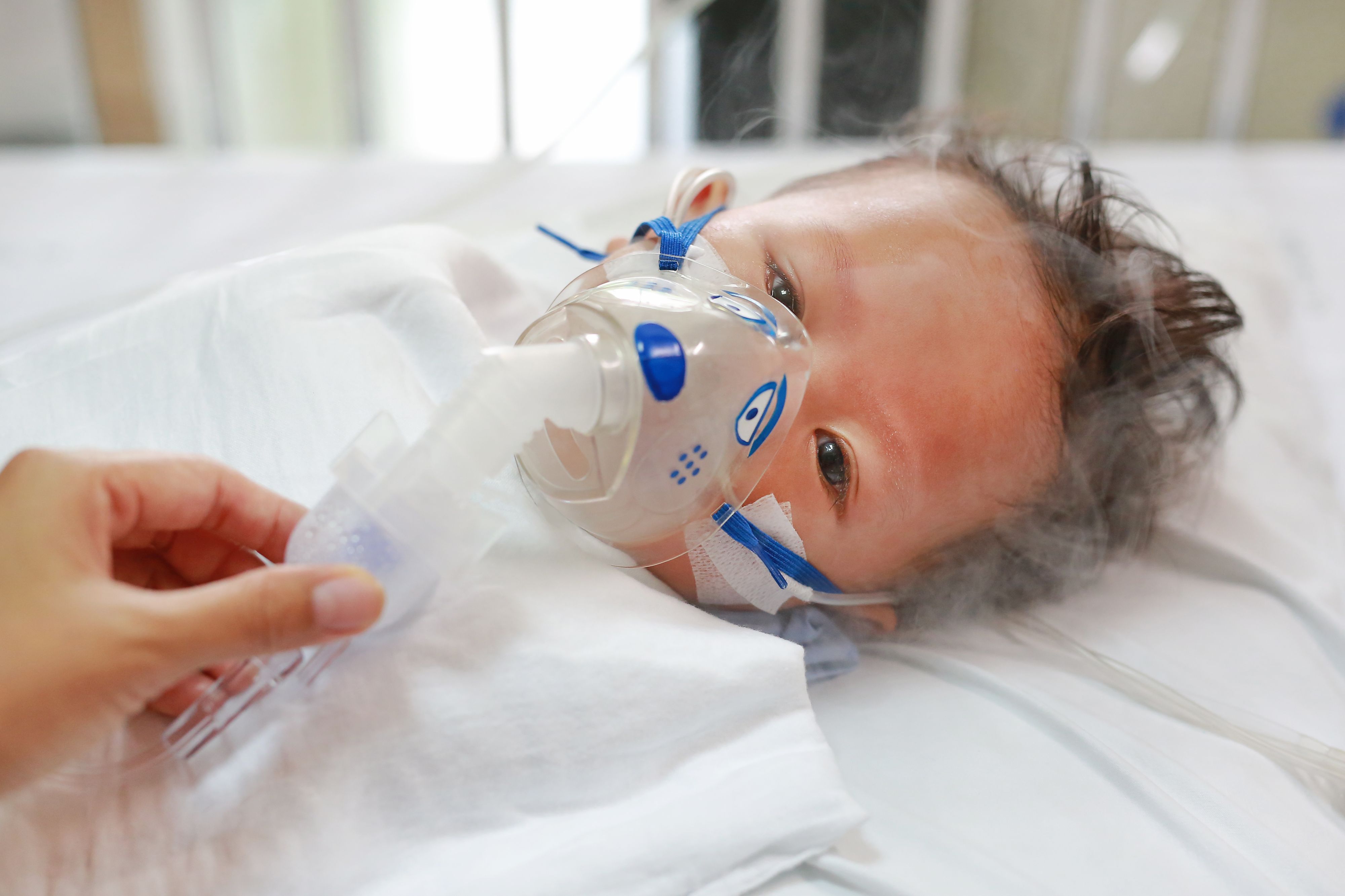 Sick baby boy applying inhale medication by inhalation mask to cure Respiratory Syncytial Virus (RSV) on patient bed at hospital.
