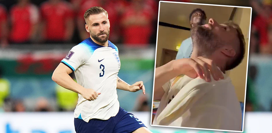 Luke Shaw wurde Vogelkot-Opfer