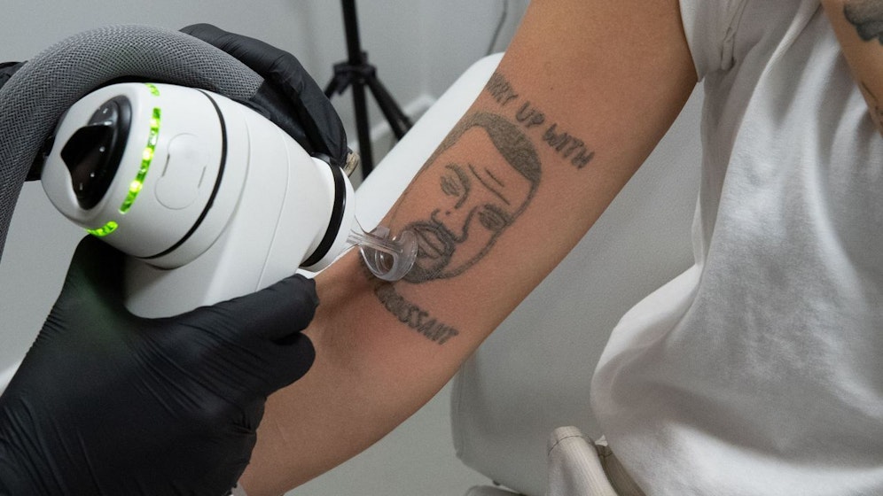 Kanye West Tattoos werden in einem Londoner Tätowierungssalon kostenlos entfernt.