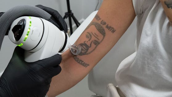 Kanye West Tattoos werden in einem Londoner Tätowierungssalon kostenlos entfernt.