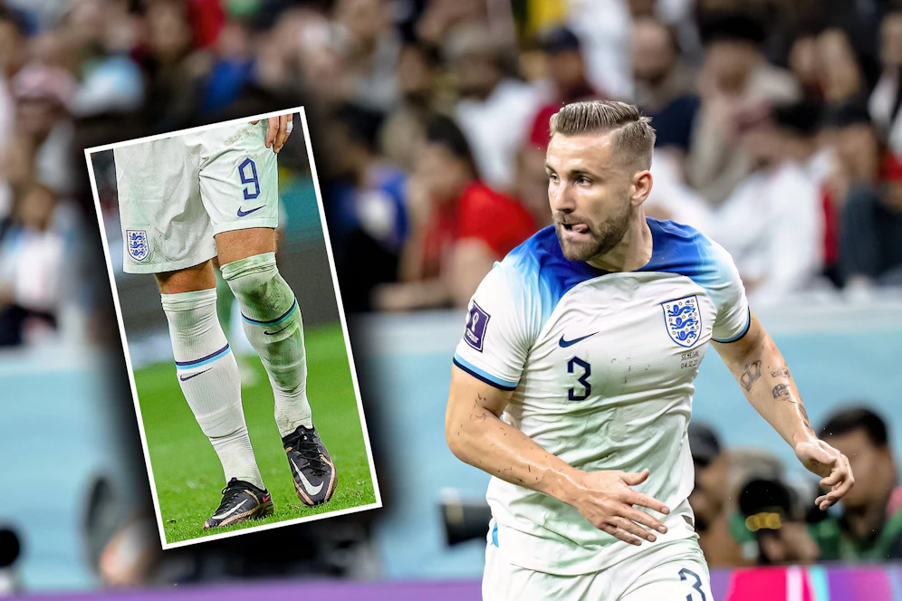 Die England-Spieler beklagten grüne Flecken auf ihren Trikots.