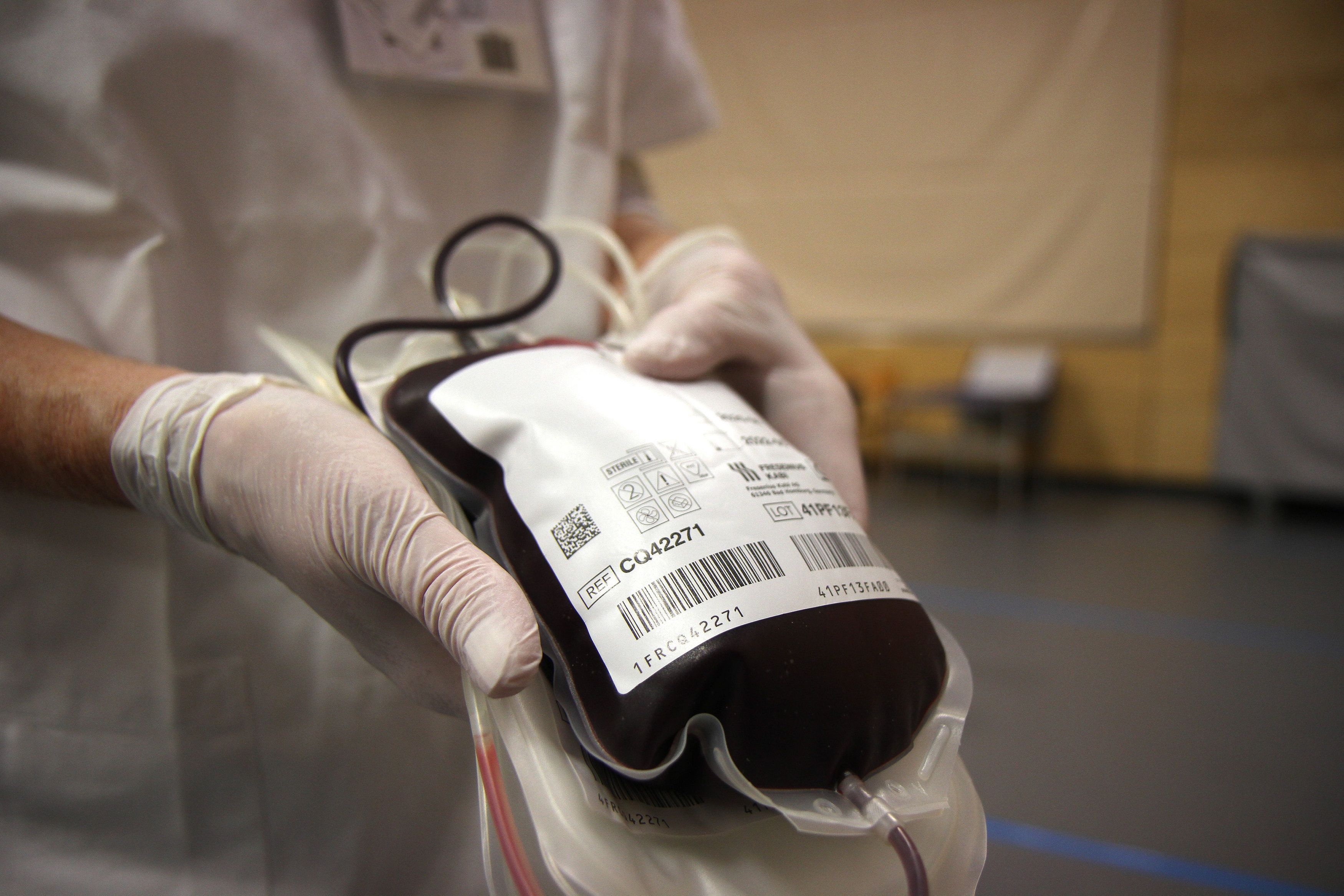 Download von www.picturedesk.com am 07.12.2022 (11:33).  SYMBOLBILD - Blutabnahme, Blutspende, Spender, Blutbeutel, Blutplasma, Reagenzen, Rägenzen, Reagenzgläschen, Rägenzgläschen, Reagenzglas, Detailaufnahme mit der Kanüle, Nadel an einem Arm eines freiwilligen Blutspenders // Blood collection, blood donation, donor, blood bag, blood plasma, reagents, reagent, test tube, test tube, test tubes, test tube, close-up with a cannula, needle on an arm of a voluntary blood donor. EXPA Pictures © 2020, PhotoCredit: EXPA/ Eibner-Pressefoto/ Fleig *****ATTENTION - OUT of GER***** - 20201204_PD7050 - Rechteinfo: Rights Managed (RM)