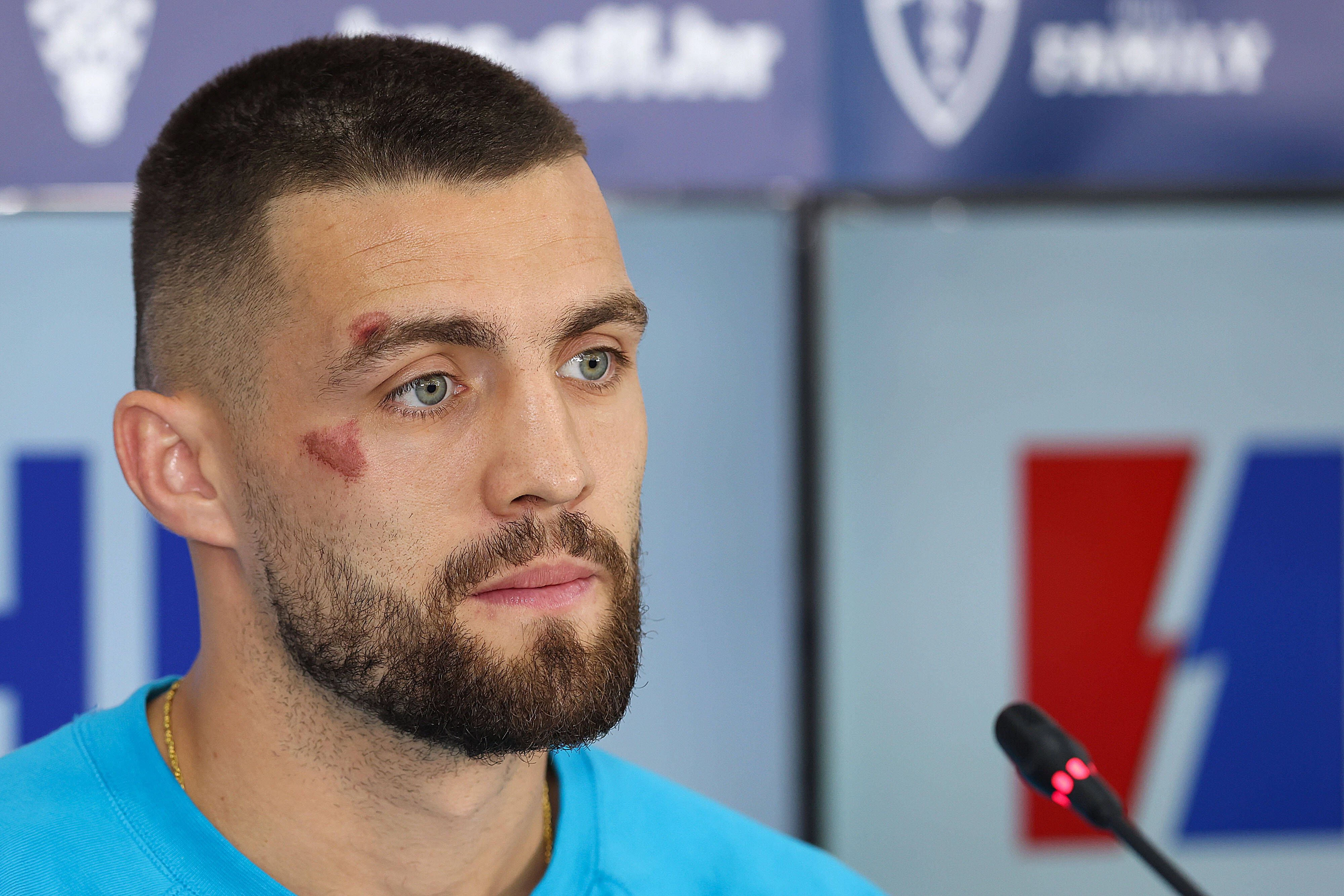 Mateo Kovacic erschien am Mittwoch zu einer Pressekonferenz mit einer Wunde im Gesicht. 