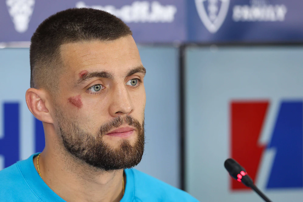 Mateo Kovacic erschien am Mittwoch zu einer Pressekonferenz mit einer Wunde im Gesicht. 