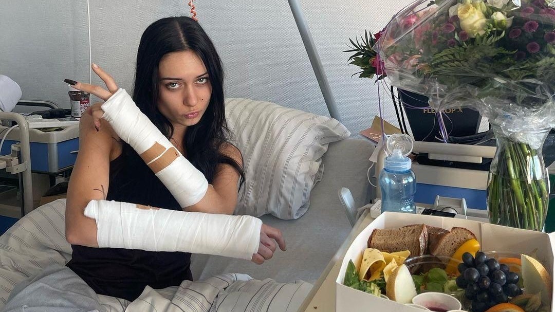 "Sah meine offenen Knochen" – Kayla Shyx bricht sich in Liveshow beide Arme