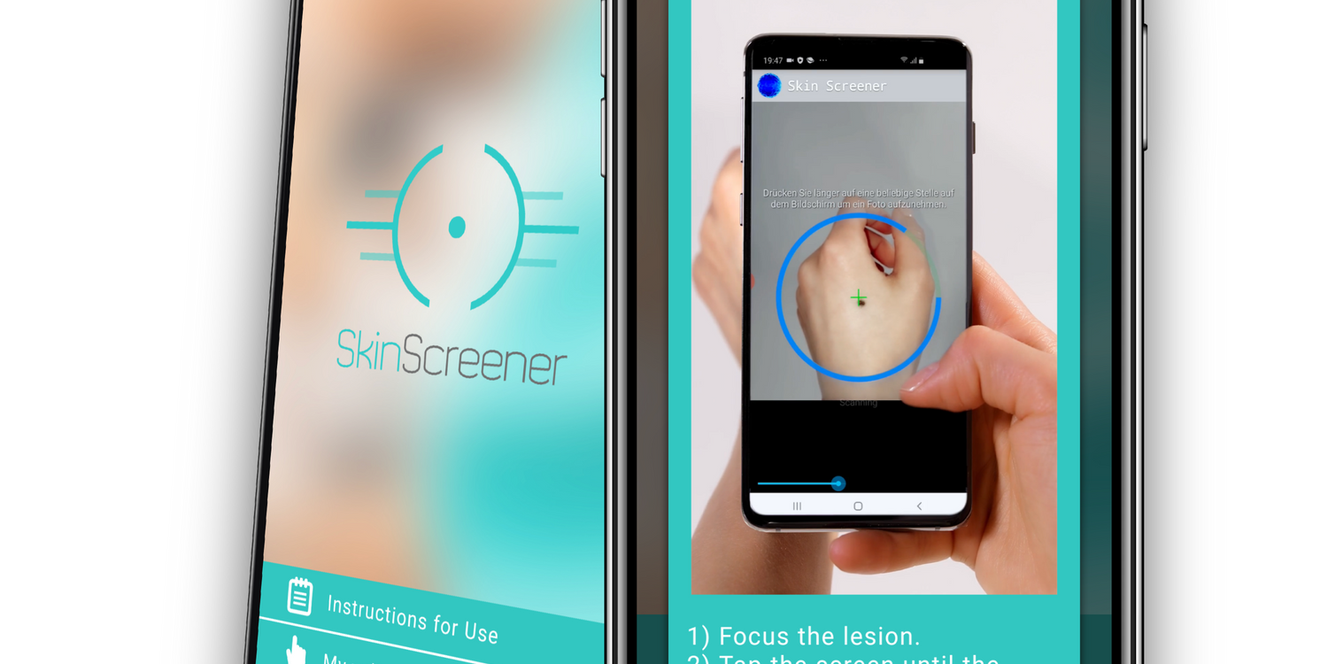 "Skinsreener" ist eine neue App zur Hautkrebsrisikobewertung.