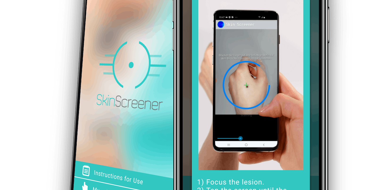 "Skinscreener" ist eine neue App zur Hautkrebsrisikobewertung.