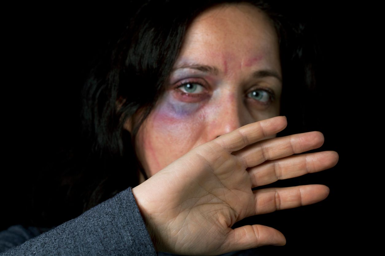 Domestic violence victim, a young  woman being hurt