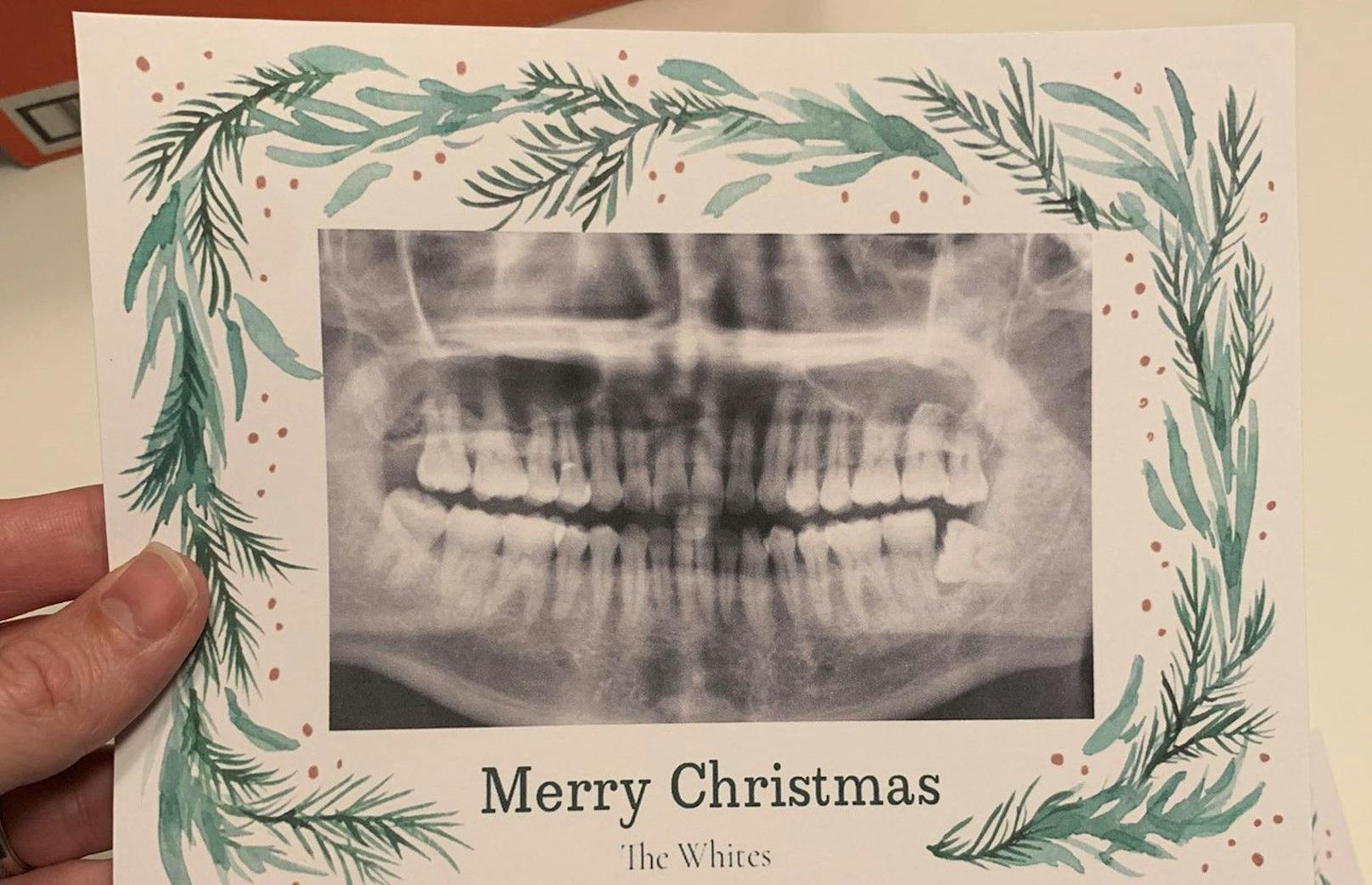 Nicht nur, dass ein Zahnröntgen die Karte ziert, ist sie auch noch mit "Frohe Weihnachten wünschen die Whites" unterschrieben.