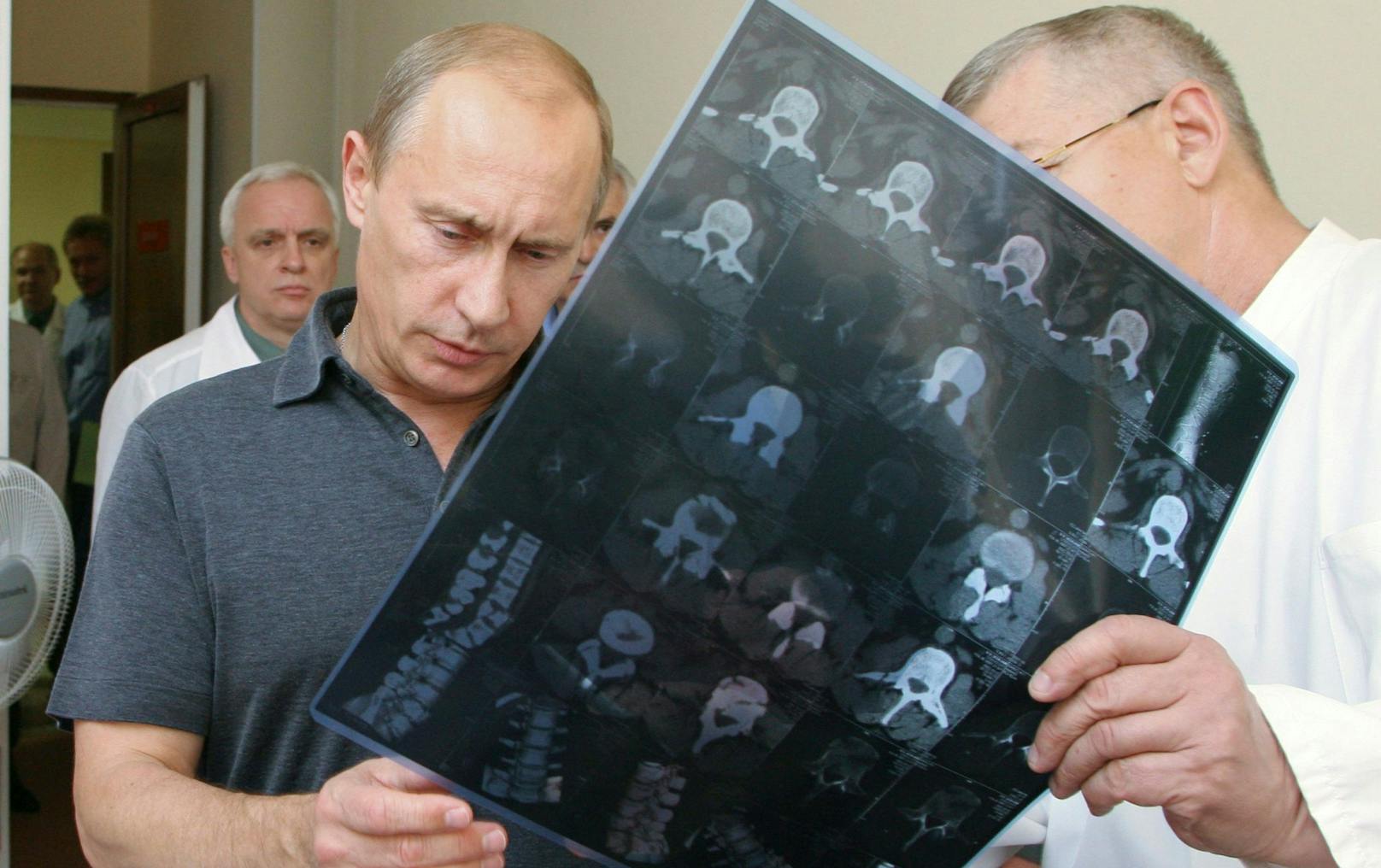 Trotz der fortschrittlichen Behandlung soll "das Ende bereits in Sicht" sein: Wladimir Putin.