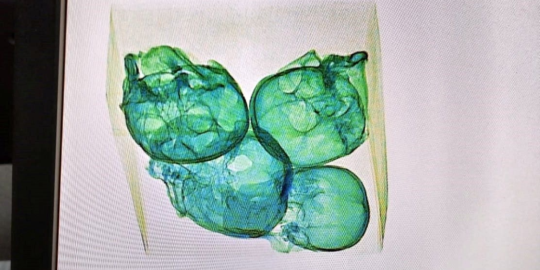 Diese vier Menschenschädel wurden am Flughafen Querétaro in Mexiko gefunden.