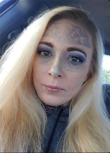 Nachdem sie zweimal im Gefängnis landete, entschied sich Zebrasky, eine Drogenentziehungskur zu machen und ihre Gesichtstattoos entfernen zu lassen. Anfang Januar 2023 zeigt sie sich auf Social Media ohne Tätowierungen.