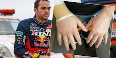 Walkner zeigt kaputte Hand: Gibt er bei Dakar auf?