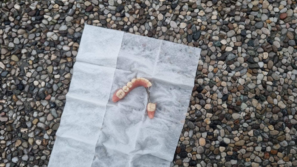 In der Wildbergstraße höhe Brucknertower in Linz wurde am Montag ebenfalls eine Zahnprothese gefunden. Woher sie stammt ist unklar.