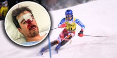 Ski-Ass meldet sich nach Adelboden-Sturz mit Blut-Foto