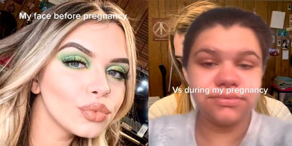 TikTokerin Savanna Scott Lenfestey (Bild) war schockiert, wie sich ihr Gesicht in der Schwangerschaft veränderte.