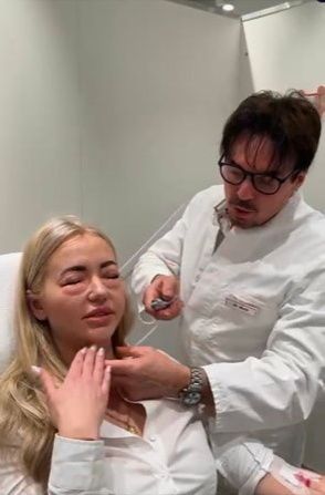 Schönheits-Arzt Bruce Reith setzt die CO2-Injektionen unter anderem gegen Augen-Falten und Doppelkinn ein.