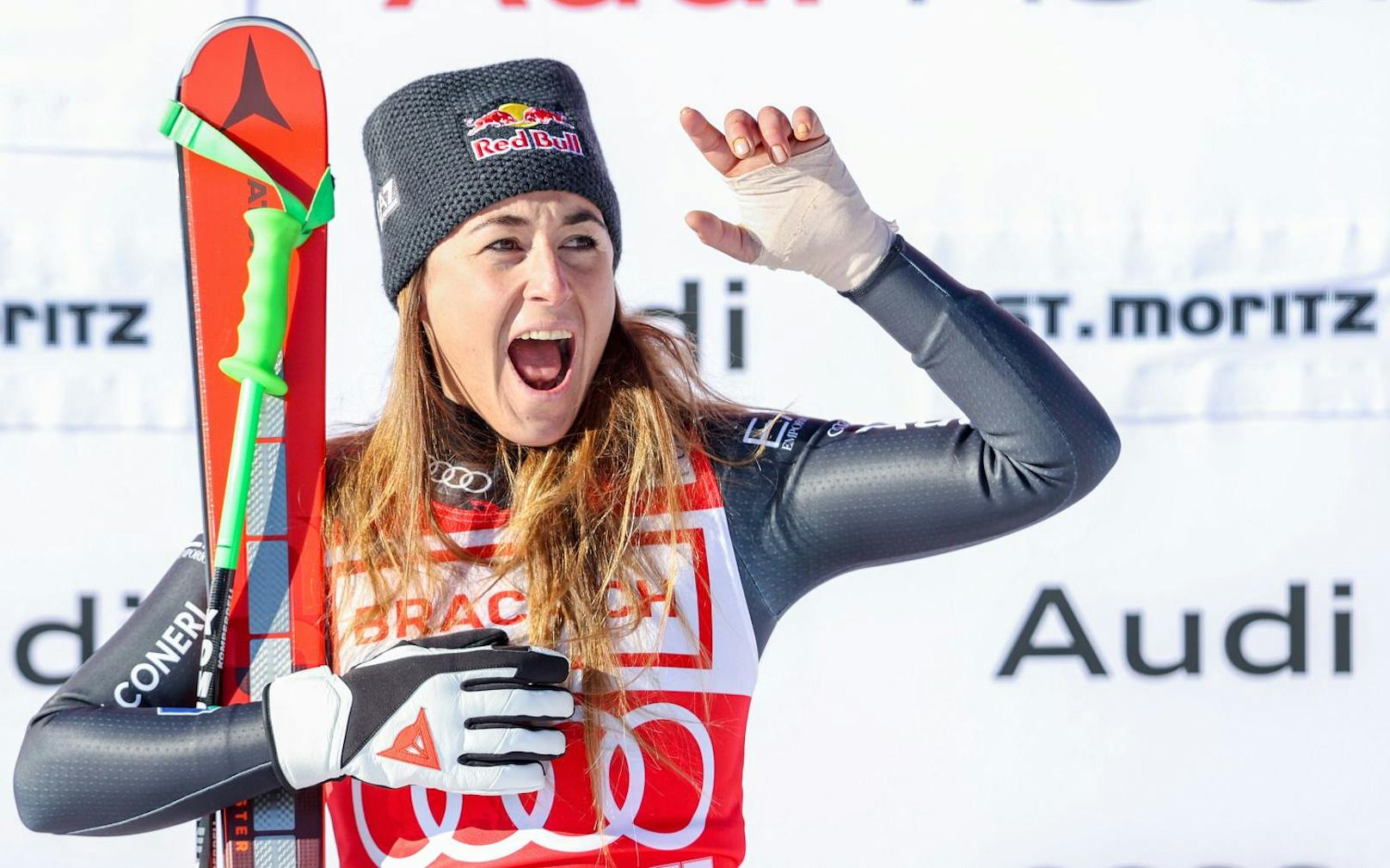 <strong>Sofia Goggia:</strong> Unglaubliches Blitz-Comeback! Die Italienerin brach sich in St. Moritz im Super-G den Mittelhand-Knochen gebrochen. 24 Stunden später raste Goggia zum Abfahrtssieg in der Schweiz.