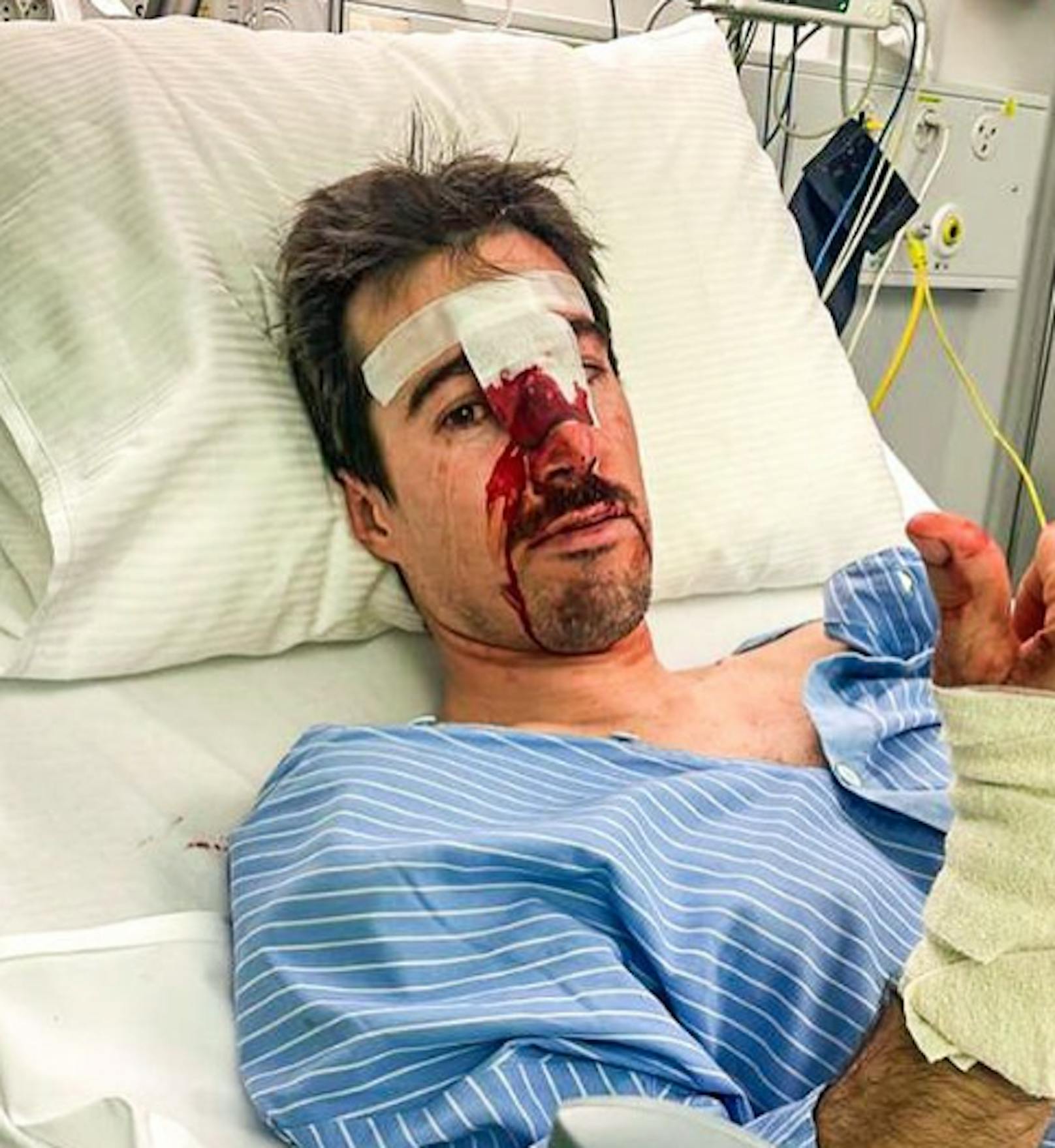 <strong>Victor Muffat-Jeadnet:</strong> Horror-Abflug in Adelboden! Der Franzose knallte mit dem Kopf auf die pickelharte Piste, zeigte dann sein blutiges Gesicht im Spital.