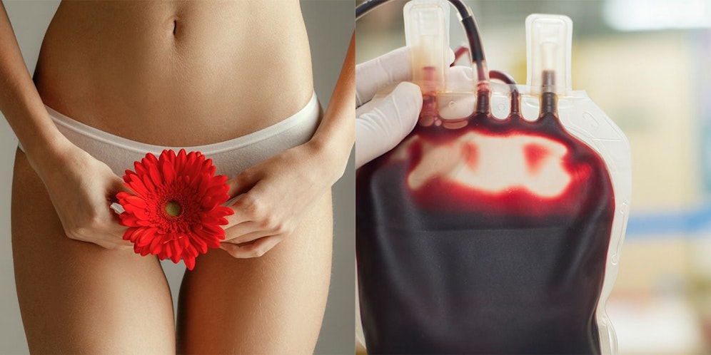 Ronny Maye leidet nicht nur am Polyzystischen Ovarialsyndrom (PCOS), sondern auch an einem Gebärmuttermyom und Endometriose. (Symbolbild).