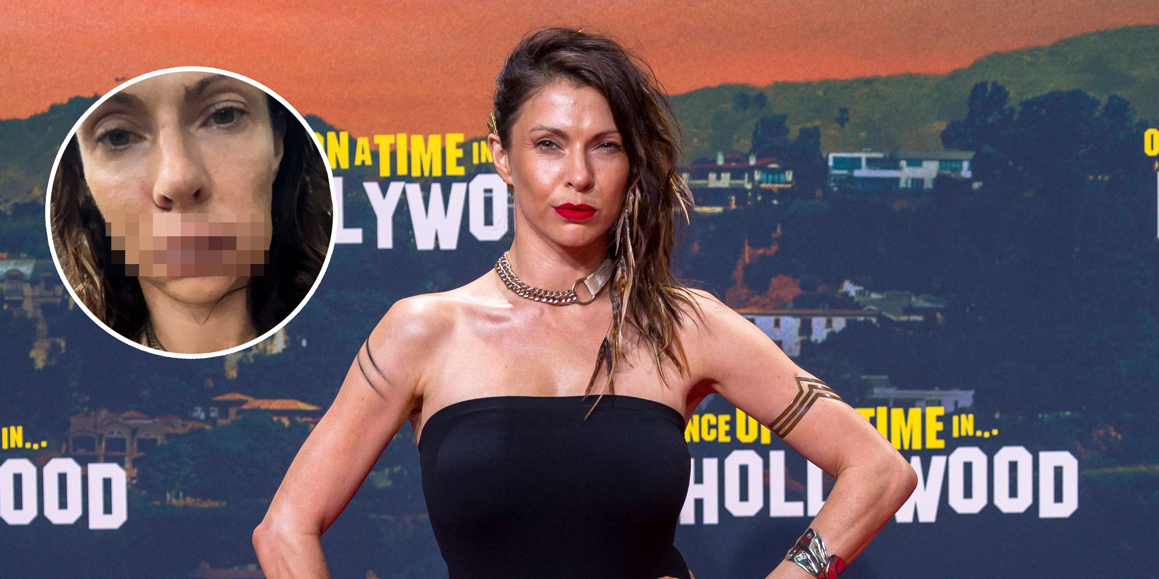 Jana Pallaske zeigt die brutalen Fotos auf Insta.