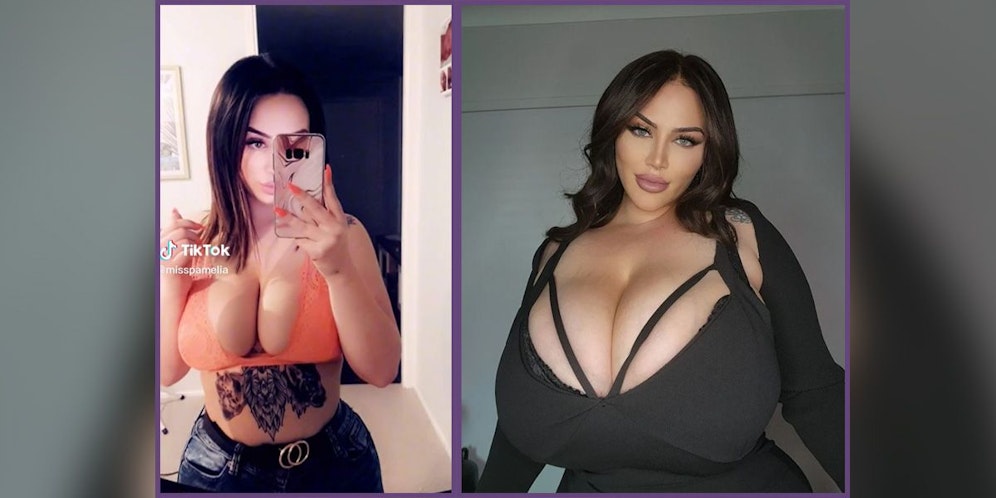 Ihre übergroßen Brüste bescheren Pamelia James körperliche und psychische Probleme.