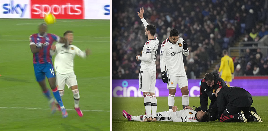 Lisandro Martinez musste nach einem Ellbogenschlag behandelt werden. 