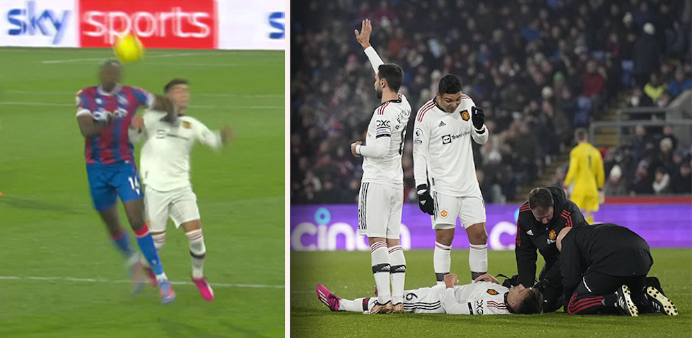 Lisandro Martinez musste nach einem Ellbogenschlag behandelt werden. 