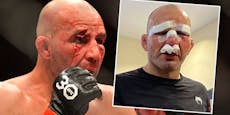 UFC-Fighter zeigt Blut-Fotos und setzt harten Schritt