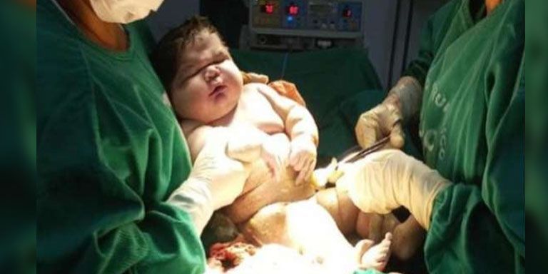 Angerson war bei seiner Geburt 59 Zentimeter groß und wog 7,328 Kilogramm.