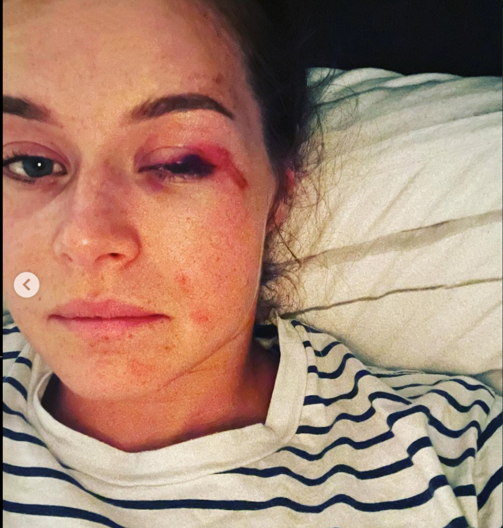 Corinne Suter nach dem Sturz in Cortina.