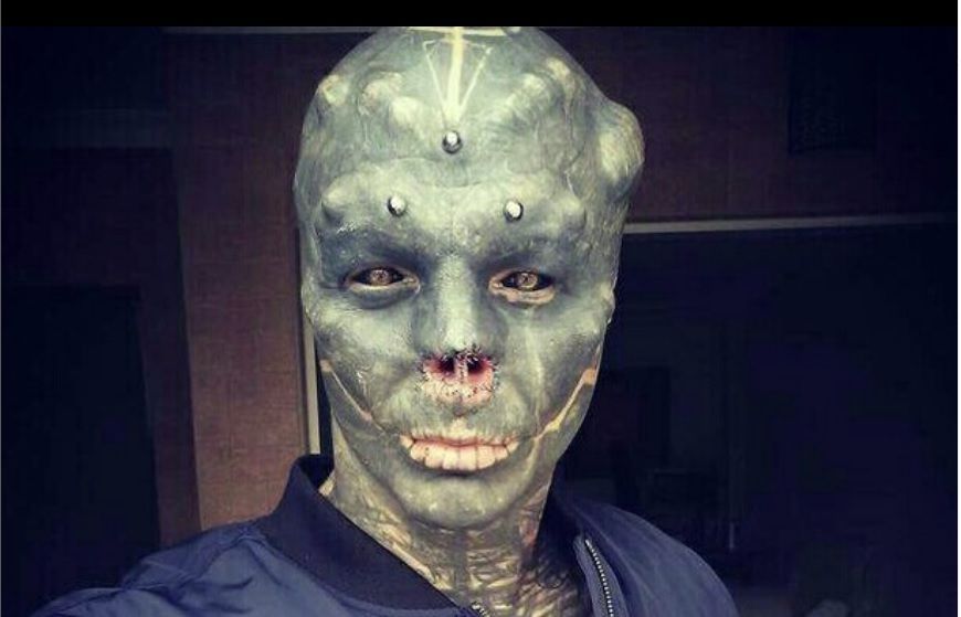 Anthony Loffredo darf wegen seinem Aussehen keine Restaurants besuchen.