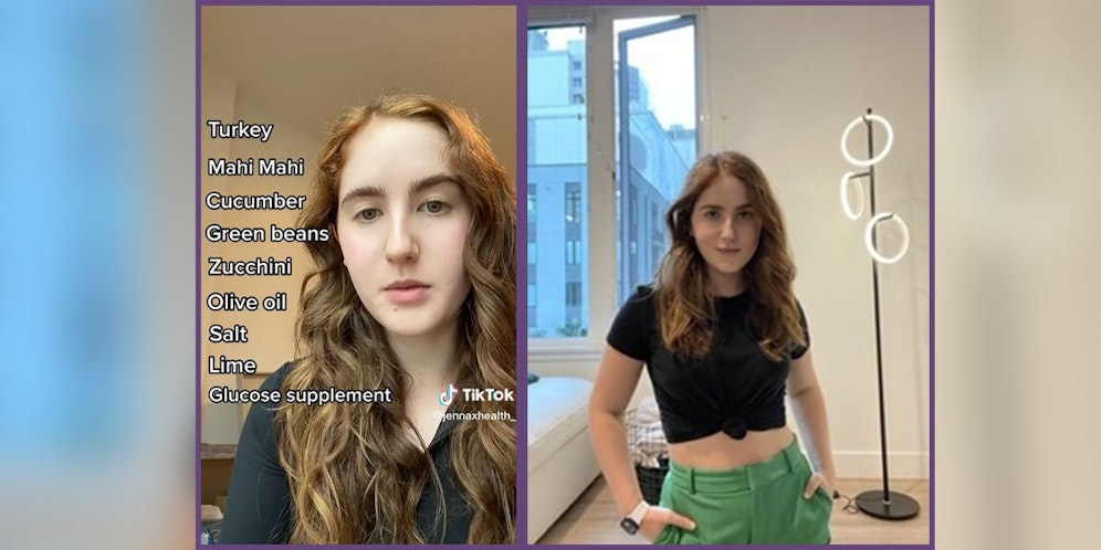 Die jahrelange Einschränkung ihrer Ernährung hat dazu geführt, dass Jenna (Bild) nur noch eine Handvoll Dinge essen kann. 