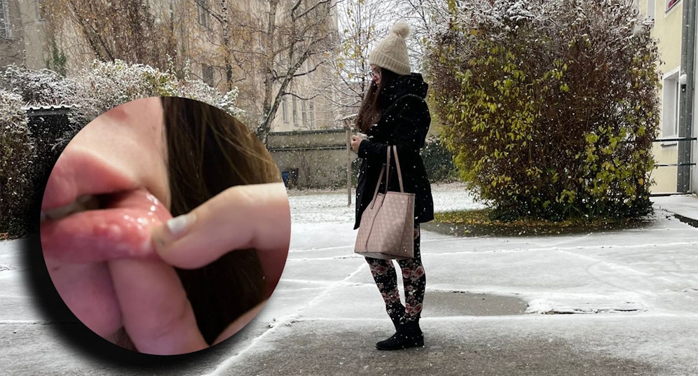 Eine 24-jährige Wienerin zeigt ihre Lippen.