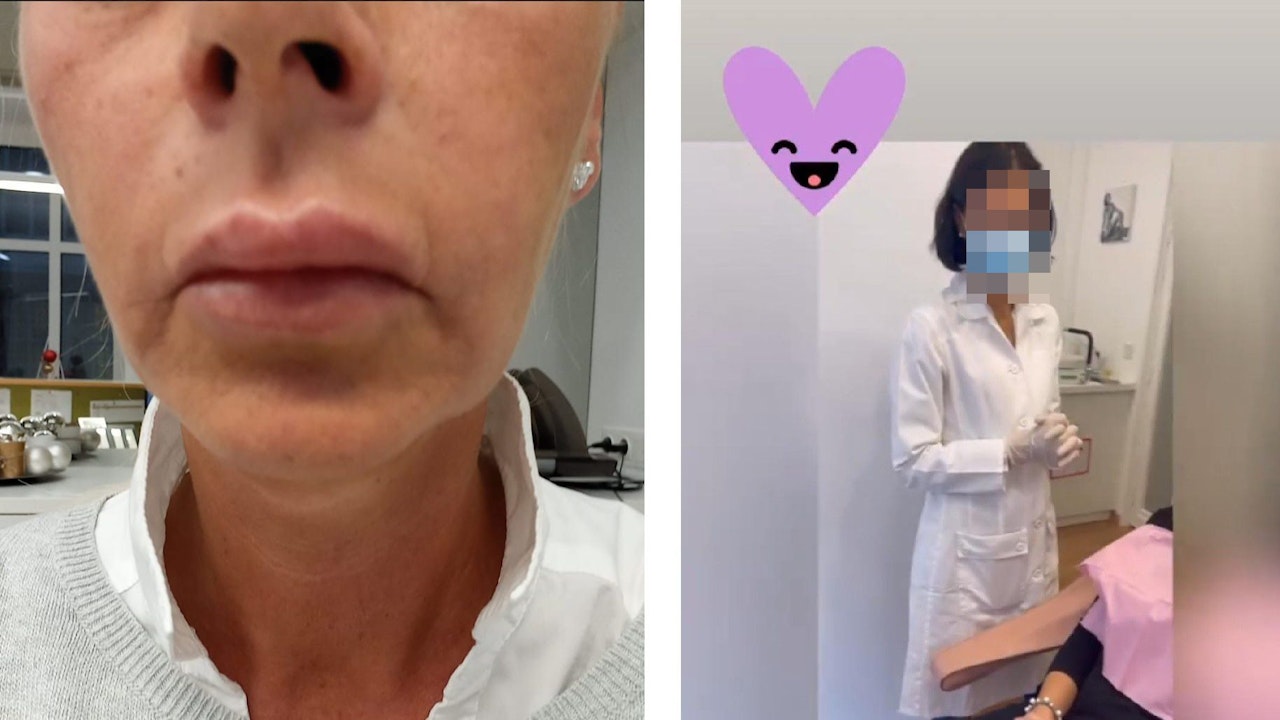 Heute.at - Beauty-Pfusch: Ich hatte Todesschmerzen bei OP