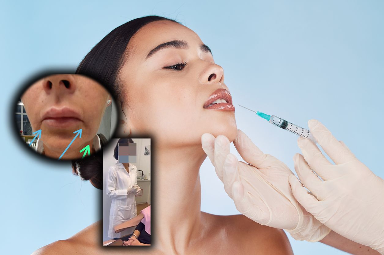 Eine Lippenkorrektur aus Jänner 2022 verfolgt eine <em>