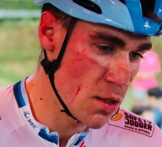 Jakobsen ist vom Handy eines Zuschauers schwer gezeichnet.