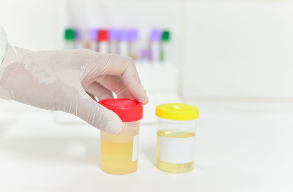 Für einen Drogentest verwendeten zwei Mädchen fremden Harn. (Symbolbild)