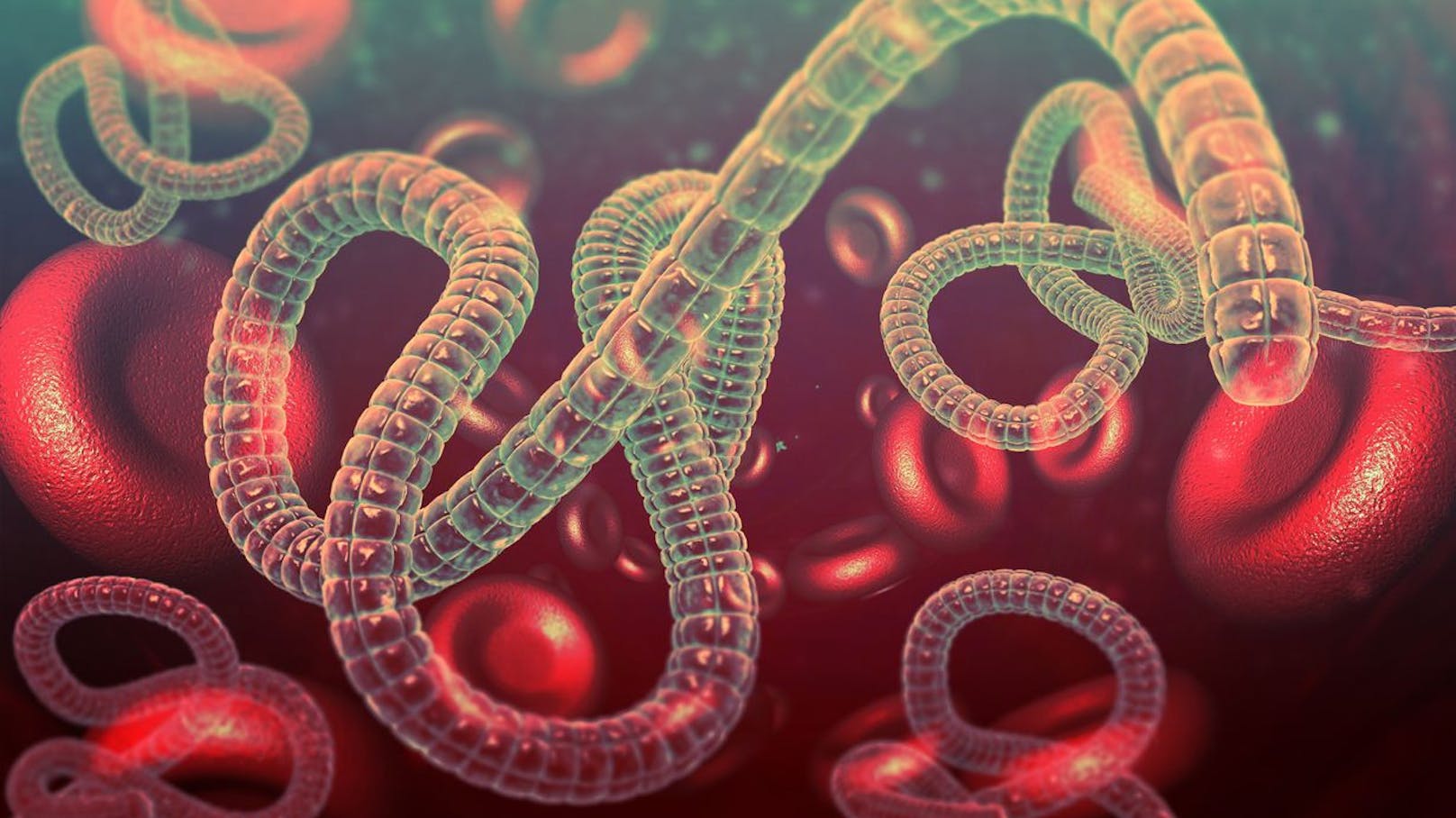 <strong>Platz 2: Ebola</strong> ist eine seltene und lebensbedrohliche Infektionskrankheit, die durch das Ebolavirus verursacht wird. Bislang gibt es keine wirksamen Medikamente dagegen, aber eine Schutzimpfung. Es vergehen im Mittel 8 bis 9 Tage zwischen der Ansteckung und dem Ausbruch. Symptome sind Hohes Fieber, Hautausschlag, Gliederschmerzen und schwere innere und äußere Blutungen. Im weiteren Verlauf von Ebola versagen häufig verschiedene Organe. Der Tod tritt oft schon nach wenigen Tagen ein.&nbsp;