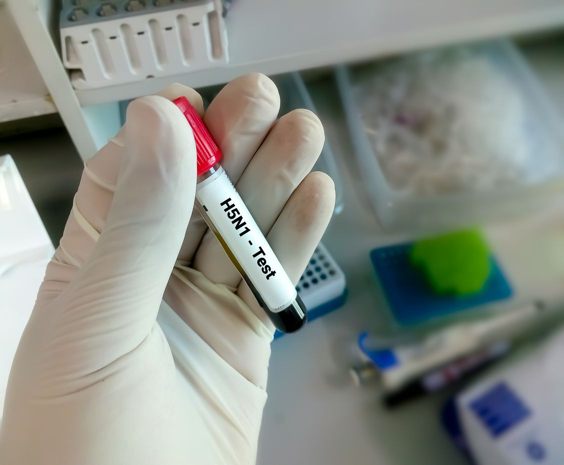 Blood sample for H5N1 test