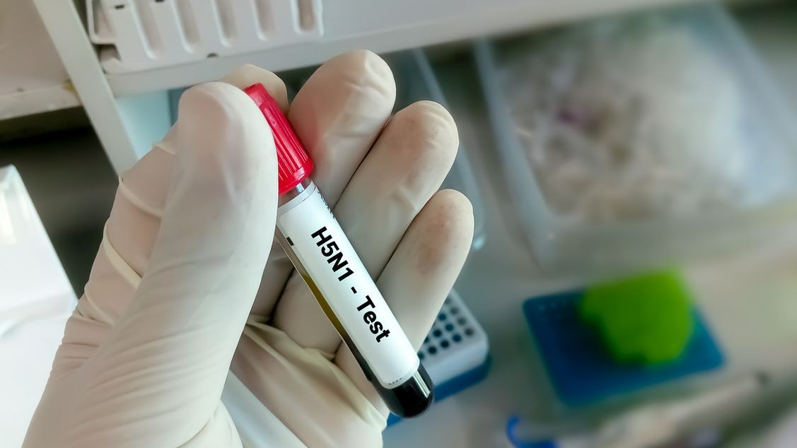 Blood sample for H5N1 test