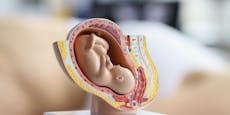 Abtreibungsgegner schicken Plastik-Embryos an Politiker