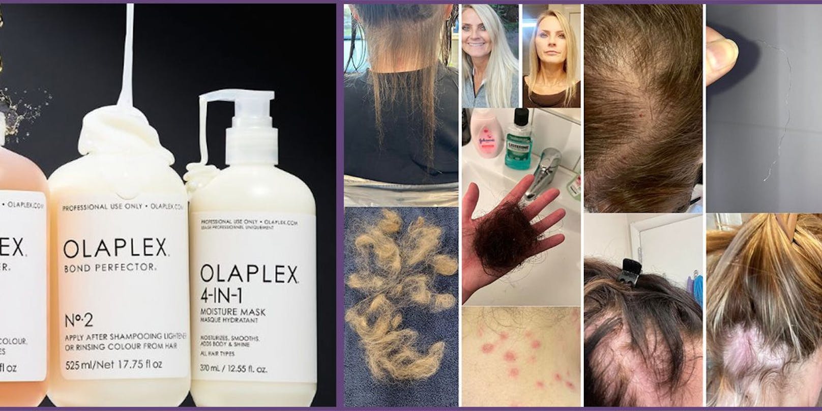 Olaplex soll kaputtes Haar reparieren, hat aber bei vielen Frauen genau das Gegenteil bewirkt.&nbsp;