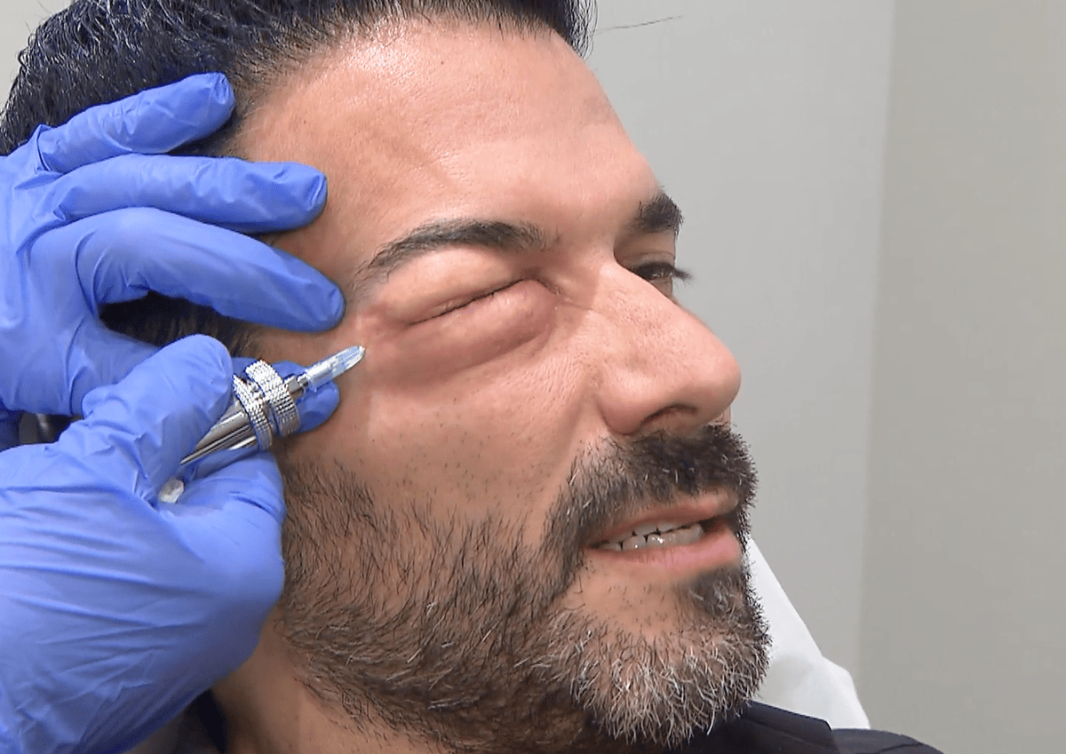 Marc Terenzi beim Beauty-Doc.