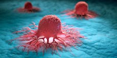 Krebsimpfung – Biontech startet Studien an Patienten