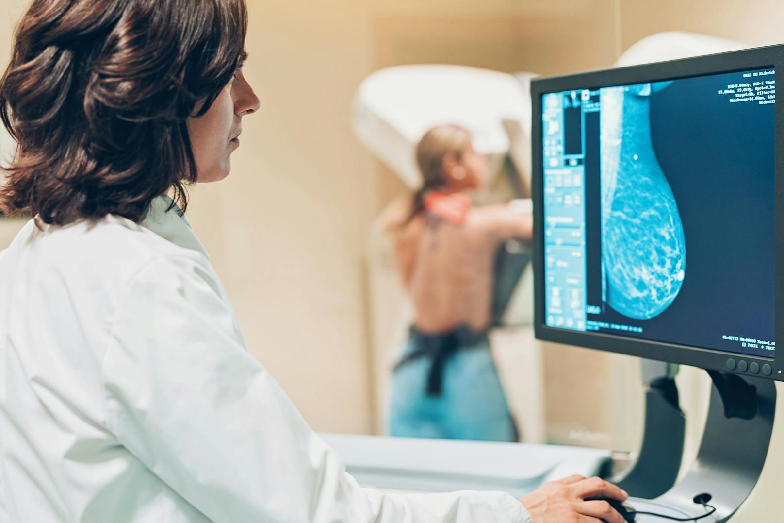 Eine Mammographie sollte regelmäßig stattfinden.